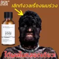 Herbal Extract☆SKIN EVER น้ำมันปลูกผม เซรั่มใส่ผม,เร่งผมยาว,ปรับปรุงผมร่วงเซรั่มปลูกผม เซรั่มบำรุงผม ยาปลูกผมของแท้ น้ำยาปลูกผม น้ำยาเร่งผมยาว