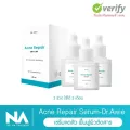 Dr.Awie Acne Repair Serum เซรั่มลดสิว 3 ขวด 60 ml เซรั่มเนื้อบางเบา ซึมไว ไม่เหนียว ผิวใส ลดสิว สิวอุดตัน ความมัน ลบรอยสิว ด่างดำ ออเกนิค เด็กใช้ได้