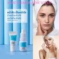 Active acne cream & acne lotion, active, also cream and acne lotion, acne, acne, acne, acne Teenagers are acne, face acne, oily face, acne cream.