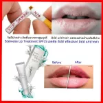 Giffarine Eddal West Lip Team to reduce dark spots, dark lips nourish the lips, dry mouth.