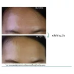 Quente Pause Age Serum Tighten pores, clear face, soft, moisturized face, can be used in all skin types, even sensitive skin 30ml.