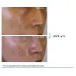 Quente Pause Age Serum Tighten pores, clear face, soft, moisturized face, can be used in all skin types, even sensitive skin 30ml.