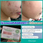 Welpano Expert Scar Care Gel Plus 2 หลอด