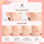 HAAR x MAAI Anti Acne Skin Renewal System แอมเพิล Ampoules Encapsulated Salicylic Acid Bioran Flower Acids ผิวใส ไร้สิว ริ้วรอย ผิวแพ้ง่าย