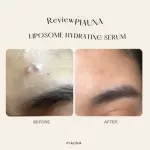 Piauna Liposome Hydrating Serum. All ends. Acne problems, acne marks, oily skin formulas for