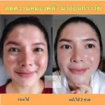 ส่งฟรี!! เซรั่มผิวหน้า โอเค ยัง ฟิลล์ล็อก OK Young Fillox Face Serum