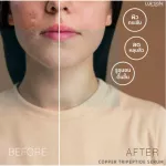 [Ready to ship free] Lur Skin Copper Tripeptide Serum 3% 30 ml. Skin reduction serum, tightening pores, reducing acne marks.