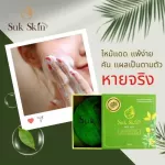 MVMALL SKIN Skin Herbal soap to cure 6 skin diseases, free 6 bubble bags and 1 zucchini.