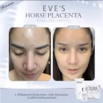 Eve's l horse overgrown serum 10ml & Bio Mind 30g, nourishing the face, white face, reduce acne marks, reduce freckles, dark spots Skin smooth, soft, moist