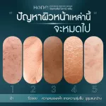 Hone Serum Hon serum [1 get 1] Young Kanchai Freckles, dark spots, acne inflammation