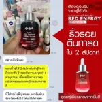 Yanheet, beautiful skin care End of wrinkles, freckles, dull skin, deep groove, crow's feet, slender face, reduce inflammation, sensitive skin, smooth skin, new formula from experts.