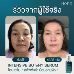 Hone Serum Hain serum, ready to deliver 100% authentic, face serum, reduce acne, freckles, wrinkles, fade down serum, clear face serum