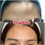 5 bottles of gold ginseng serum, free delivery !!! Ginseng Hya Gold Serum Serum Serum Ginsemble Serum Serum Serum Serum with Hairy Ron, Freckles