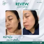 SKIN AGEM TIME MACHINE Recovery Ampoule Skin Ampul Skin Peptide Skin Bush is thicker than 1 box of skin boost 5 bars *including delivery *