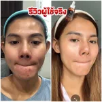 ใหม่ มาแรง !!! เซรั่มโสมทองไฮยา เซรั่มโสม รากโสม ทองคำ ไฮยารูรอน อัลฟ่าอ่าบูติน สารสกัดจากเมือกหอยทาก เซรั่มโสมทอง ลดสิว ฝ้ากระจางลง ลดริ้วรอย 1 ขวด 3
