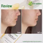 Clear face serum extracted from Centella asiatica-Skin Therabis, Skin Termis