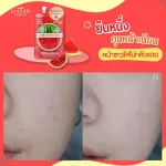 SISTAR OFFICIAL Serum freckles, radish serums-EE sunscreen, watermelon set, blemish, sunblock