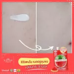 SISTAR OFFICIAL Watermelon Gel-EE EE Watermelon Set