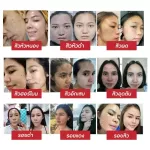 Hyada serum, clear face, acne, reduce acne marks, serum, serum, hyaluron, and Go-VC, concentrated vitamin C, Hyada cream, light texture, easy to blend.