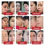 Challenge to try !!! Hyada serum, clear face without acne, serum, Vitcies & Hyada cream, light texture, and helps to restore the moisture to the skin to be full of water all day.