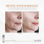 Skinmtx telozyme  เซรั่มรางวัลโนเบล ชะลอวัยถึงระดับโครโมโซม ไร้ริ้วรอย ยืดอายุเซลล์ผิว