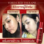 Vorda Red Therapie Serum Voda Serum [30 ml./ bottle] [1 bottle] Serum Divisara, freckles, wrinkles, emperor serums