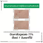 Vichy Normaderm Probio-BHA Serum 30ml-Wit, Doctor Ma Derm Bio-B. Heech A, facial skin care serum Control it and the problem with 1 bottle of acne containing 30 ml.