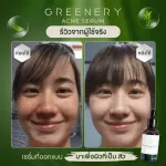 Greenery Acne Serum Green Nerry Acne Serum [30 ml./ bottle] Acne serum, natural ingredients, bamboo tester, Tea Tree Oil