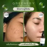 Greenery Acne Serum Green Nerry Acne Serum [30 ml./ bottle] Acne serum, natural ingredients, bamboo tester, Tea Tree Oil