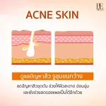 Very tight review !! Fast freckles Clear face - C ascorbic serum - Youmpress - 5 g. CSE x 1