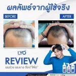 Hone Serum Lyo, Free Hon, Serum, freckles, dark spots, inflammation, acne, acne, hormonal serum, skin care, Korean formula by. Young Kanchai