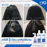 Hone Serum Lyo, Free Hon, Serum, freckles, dark spots, inflammation, acne, acne, hormonal serum, skin care, Korean formula by. Young Kanchai