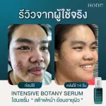 Young Kanchai Lyo, 3 bottles of value, free delivery, Hone Intensive Botany Serum 30 ml.