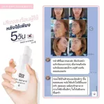 Pichlook Omijar Serum 1 get 1 serum, Omicar Serum, Korean serum, reduce acne, clear skin, freckles, dark spots, free toner, collagen boost, ready to deliver.