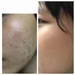 Vita Belle Hydrting Toner