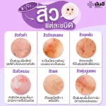 Lalis premium, membrane, membrane, blemish treatment, reduce freckles, dark spots, urgent formulas, rejuvenate the skin to be clear. Do not come back to chronic cream, blemish, especially the sun