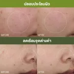 DR. Andrew Weil for Origins ™, a new recipe mushroom, Mega-Mushroom Relief & Resilience Soothing Treatment Lotion New Advanced Formula [200 ml.]