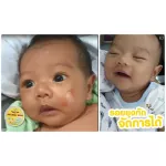 [2 Get 1] Balm, reduce swelling, no black marks, Chicky Mild, Balm Balm, 15 grams, 2 pieces of mosquito bit, get free !! Hand Spray 100ml