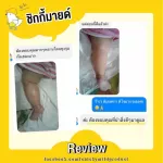 เซ็ตขายดี! ลูกแพ้ยุง! ขาลาย! โลชั่นกันยุง ช่วยลดรอยดำ รอยขาลาย 120 g และบาล์มลดคัน ลดบวม ไม่ทิ้งรอยดำ 15 g