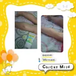 เซ็ตขายดี! ลูกแพ้ยุง! ขาลาย! โลชั่นกันยุง ช่วยลดรอยดำ รอยขาลาย 120 g และบาล์มลดคัน ลดบวม ไม่ทิ้งรอยดำ 15 g