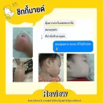 เซ็ตขายดี! ลูกแพ้ยุง! ขาลาย! โลชั่นกันยุง ช่วยลดรอยดำ รอยขาลาย 120 g และบาล์มลดคัน ลดบวม ไม่ทิ้งรอยดำ 15 g