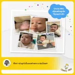 ลูกแพ้ยุง! ขาลาย! โลชั่น 50ml + บาล์ม 15ml โลชั่นกันยุง ลดรอยดำ รอยขาลาย และบาล์ม ลดคัน ลดบวม ไม่ทิ้งรอยดำ