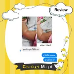 [2 แถม 1] บาล์มลดคัน ลดบวม ไม่ทิ้งรอยดำ Chicky Mild บาล์มทาหลังยุงกัด ขนาด 15 กรัม 2 ชิ้น รับฟรี!! ขนาด 5 กรัม 1 ชิ้น