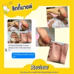 บาล์มลดคัน ลดบวม ไม่ทิ้งรอยดำ Chicky Mild บาล์มทาหลังยุงกัด ขนาด 15 กรัม สูตรสารสกัดออร์แกนิค สำหรับเด็กและผิวแพ้ง่าย