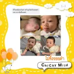 บาล์มลดคัน ลดบวม ไม่ทิ้งรอยดำ Chicky Mild บาล์มทาหลังยุงกัด ขนาด 15 กรัม สูตรสารสกัดออร์แกนิค สำหรับเด็กและผิวแพ้ง่าย