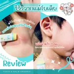 บาล์มทาหลังยุงกัด ลดรอยดำ แพ้ยุง ตุ่มแดงแก้คัน "โยเดีย บี บาล์ม"