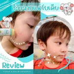 บาล์มทาหลังยุงกัด ลดรอยดำ แพ้ยุง ตุ่มแดงแก้คัน "โยเดีย บี บาล์ม"