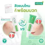 Smooth E Anti Acne Set สมูทอี คู่หูดูโอ้ จบทุกปัญหาสิว