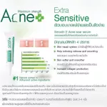 Smooth E Anti Acne Set สมูทอี คู่หูดูโอ้ จบทุกปัญหาสิว