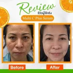 เซรั่มขุนพลนางพญา ผิวใส เซรั่มลดฝ้า กระ ผิวกระชับ เซรั่มนางพญา ขุนพล เซรั่มหัวไชเท้า  วิตามินซี 1 ขวด 15 ml. พร้อมส่ง !!